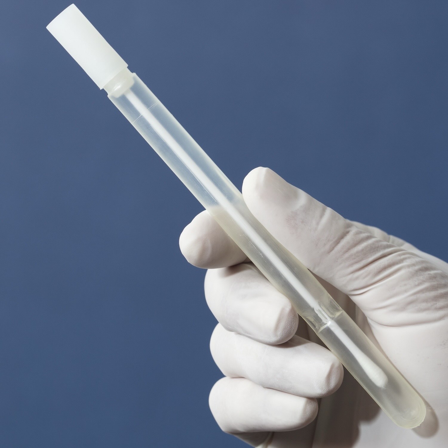 Dépistage angine et cystite, Pharmacie Cossé le Vivien à Cossé-le-Vivien, Ahuillé, Quelaines-Saint-Gault